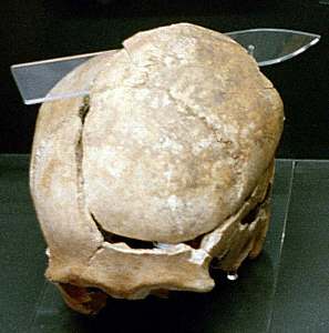 Viking-age skull with battle injuries